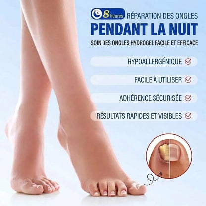 SilkEase™ Patchs Antifongiques pour Ongles & Kit de Soin