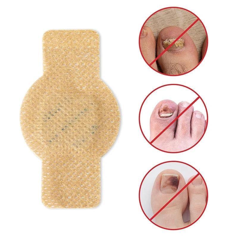 SilkEase™ Patchs Antifongiques pour Ongles & Kit de Soin