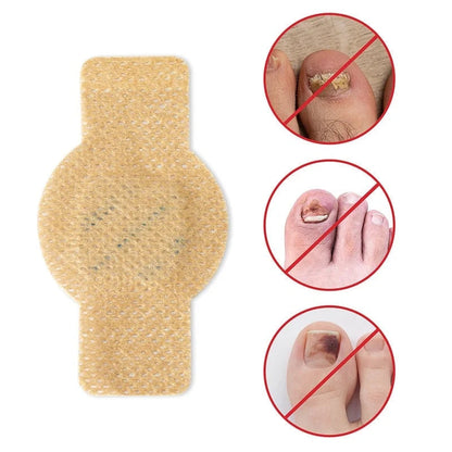 SilkEase™ Patchs Antifongiques pour Ongles & Kit de Soin