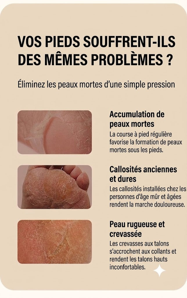 [ACHETEZ 1, OBTENEZ-EN 1 GRATUIT] Râpe anti-callosités électrique améliorée SilkEase™ | Lime à pieds rechargeable
