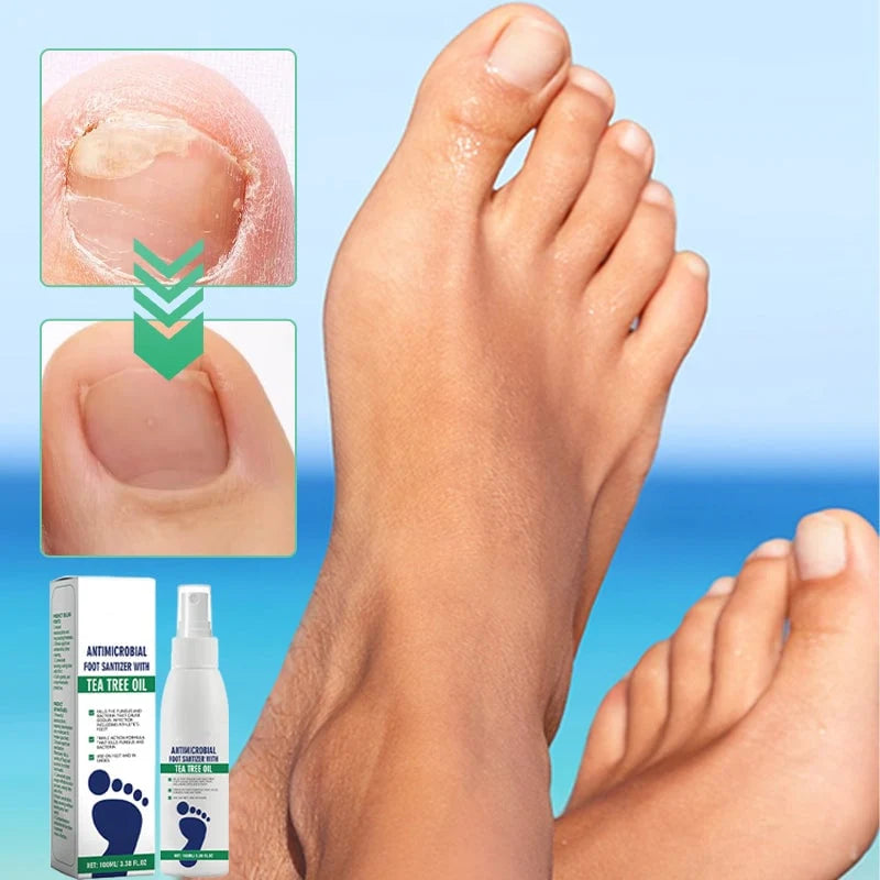 SilkEase™ Spray Pieds Antibactérien & Hydratant Intense