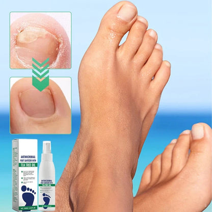 SilkEase™ Spray Pieds Antibactérien & Hydratant Intense