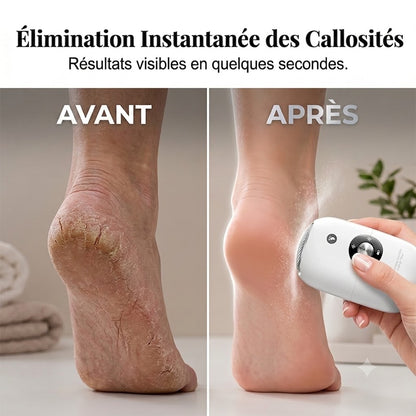 Rape à Pieds Électrique Portable – Rénovateur de Talons Automatique Anti-Callosités